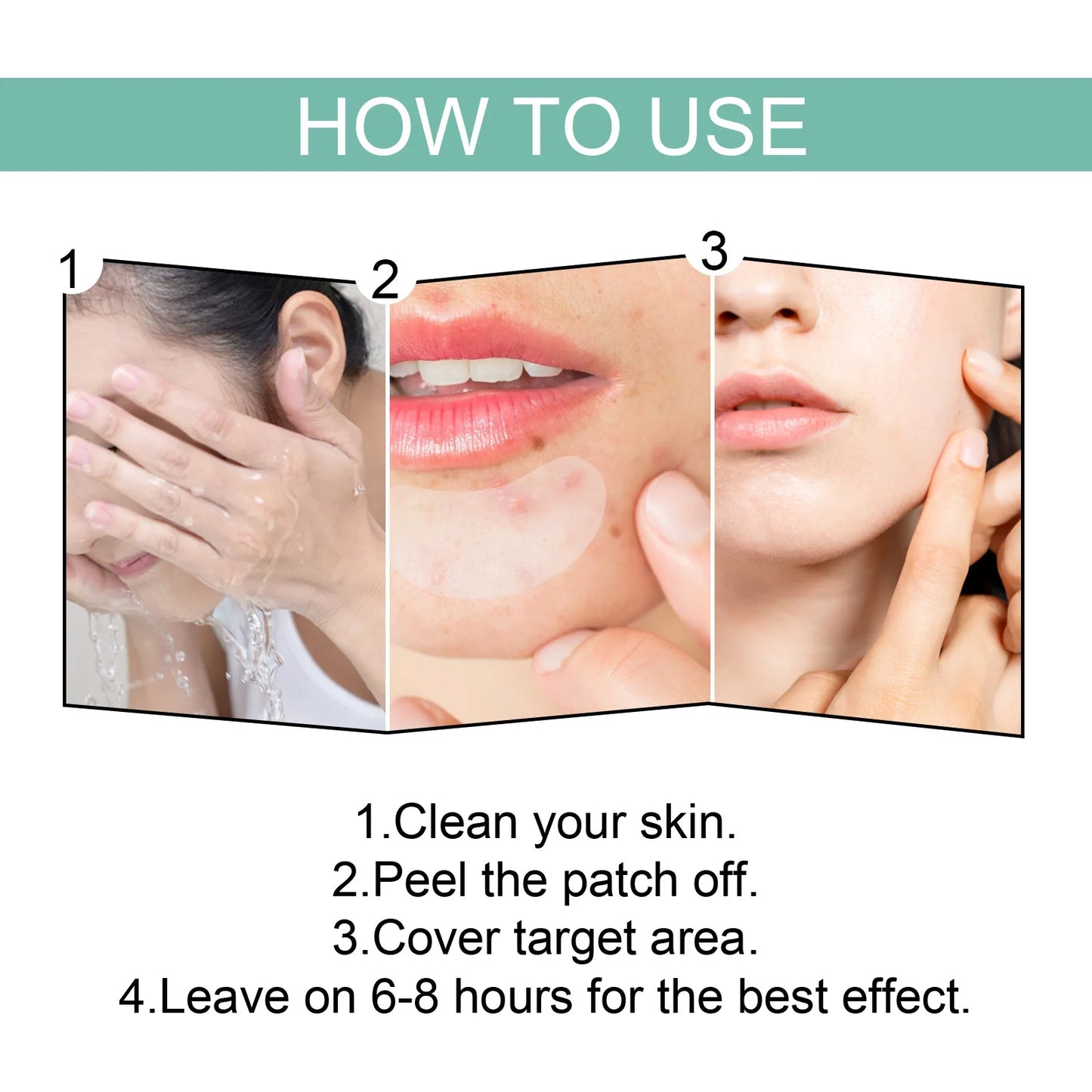 132 Pcs Hydrocolloid Acne Pimple Patches — Invisible Spot Stickers for Face
