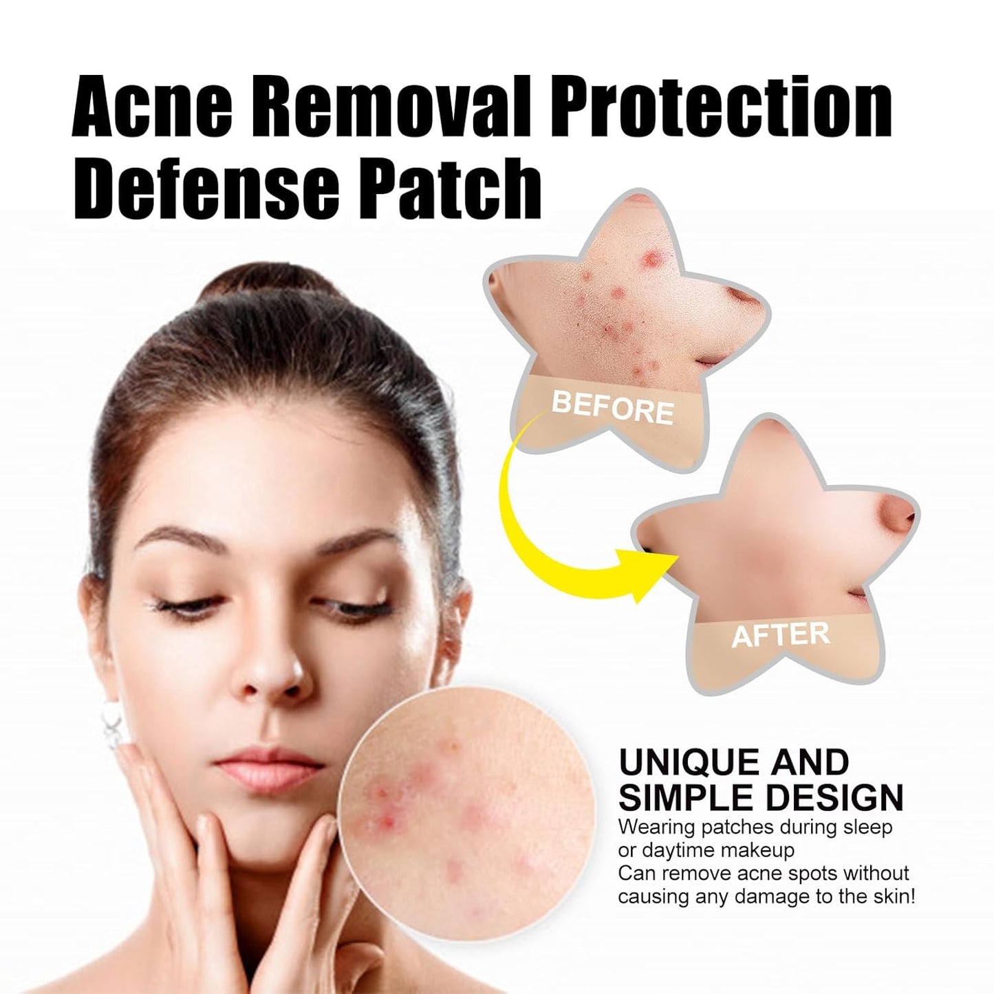 60 Pcs Hydrocolloid Pimple Patches with Tea Tree — Star & Flower Acne Stickers