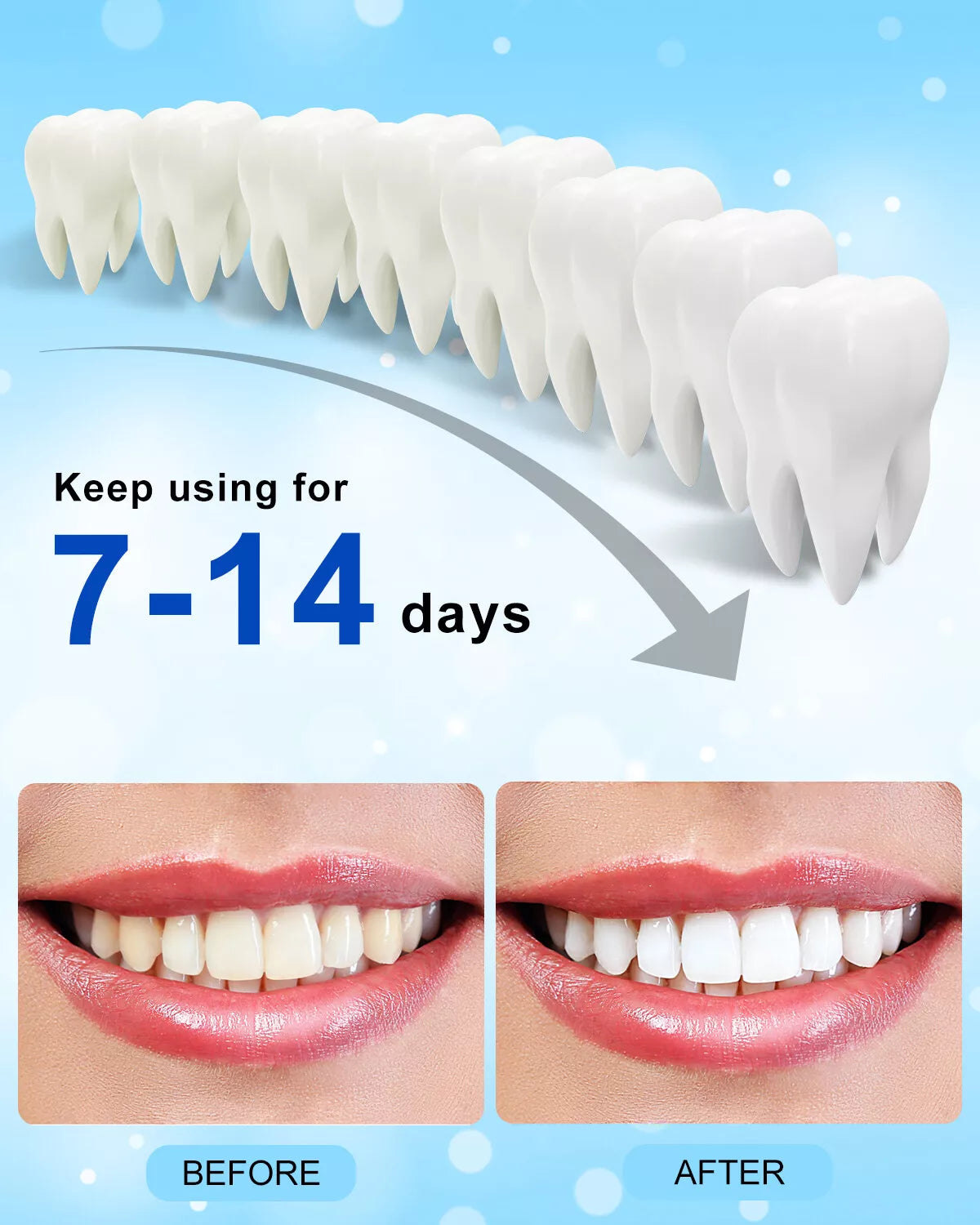 5-LED Teeth Whitening Light with Tray β Tooth Whitener Accelerator, 10-Min Timer