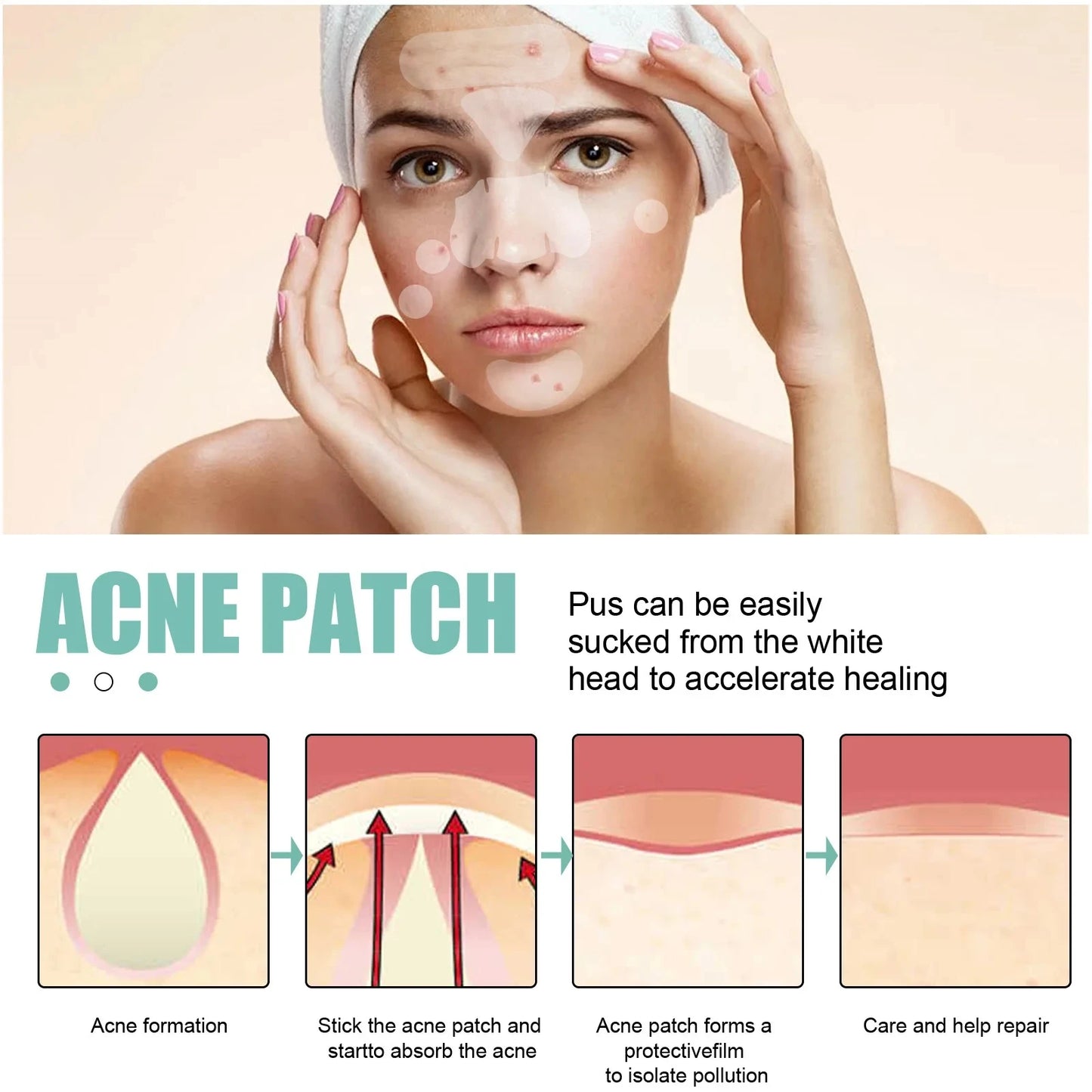 132 Pcs Hydrocolloid Acne Pimple Patches — Invisible Spot Stickers for Face
