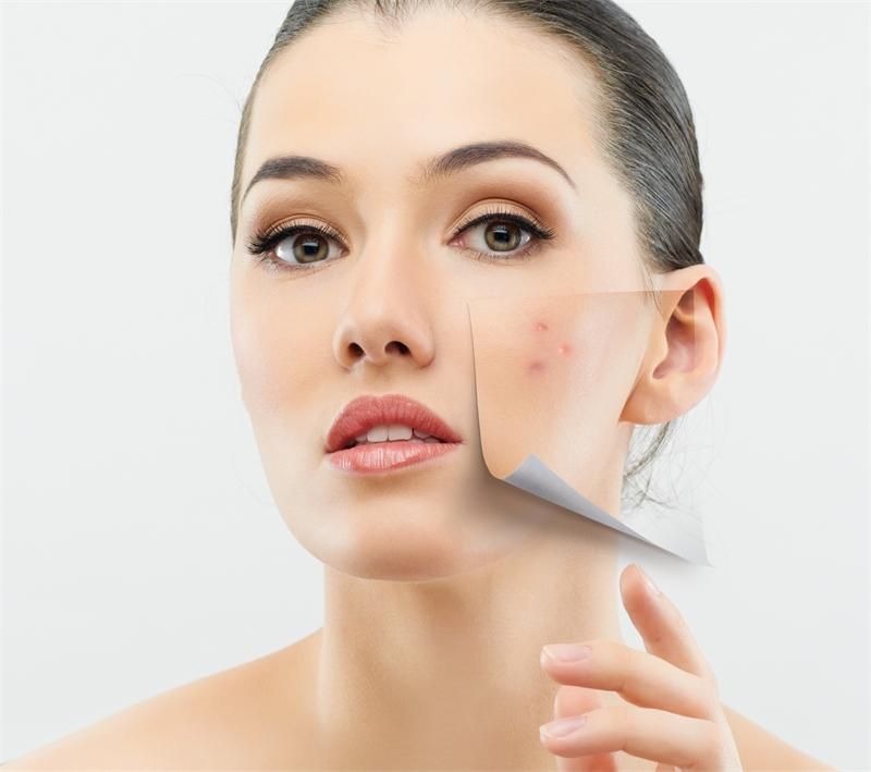 ACNE & SPOT TREATMENT