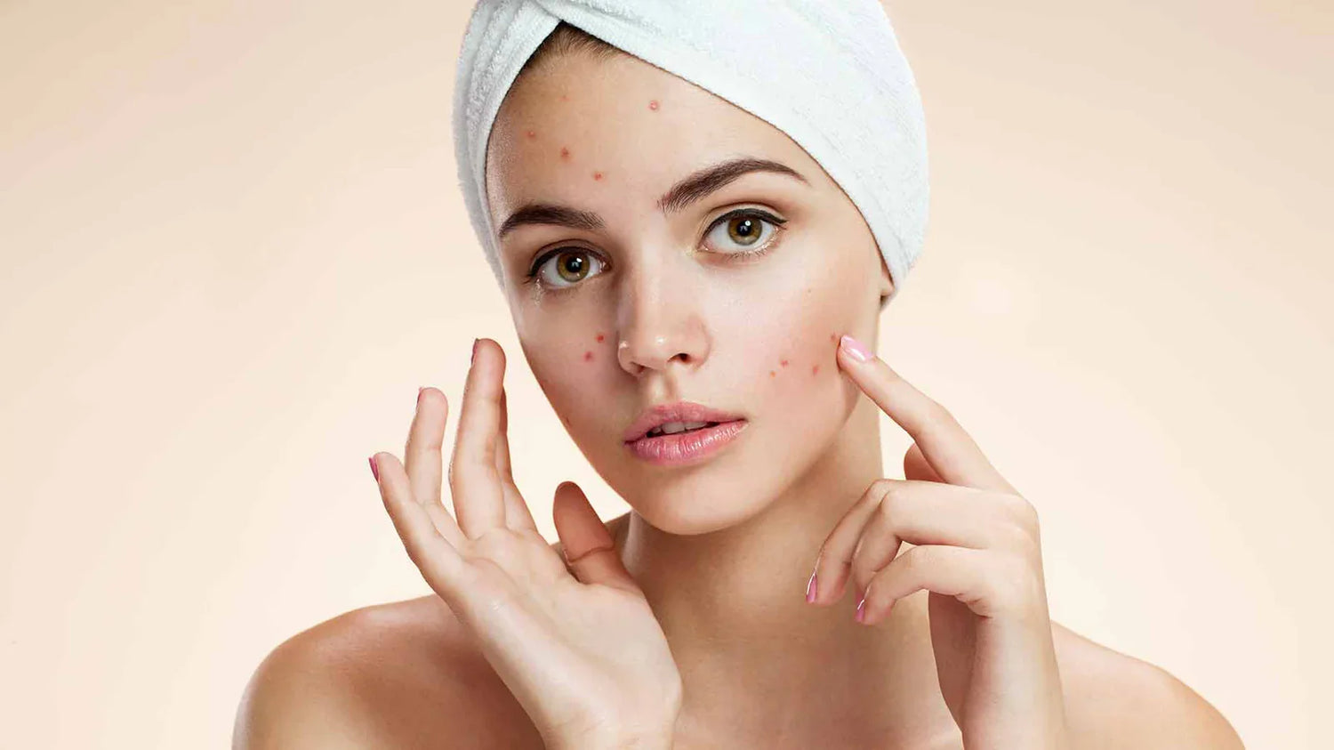 Acne & Spot Treatment