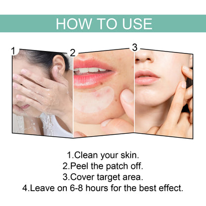 132 Pcs Hydrocolloid Acne Pimple Patches — Invisible Spot Stickers for Face