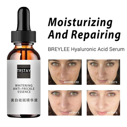 Niacinamide Facial Essence — Deep Moisturizing Serum for Pore Care & Hydration