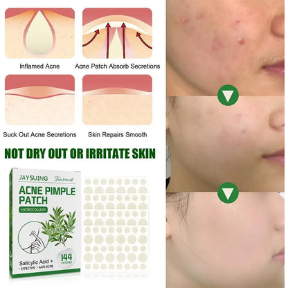 Invisible Hydrocolloid Acne Patch With Tea Tree Oil. 144 pcs.