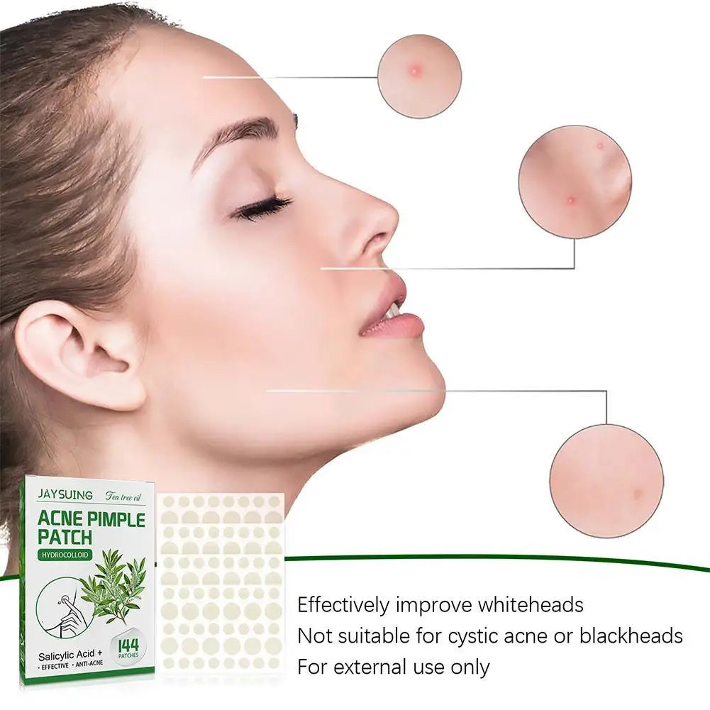 Invisible Hydrocolloid Acne Patch With Tea Tree Oil. 144 pcs.