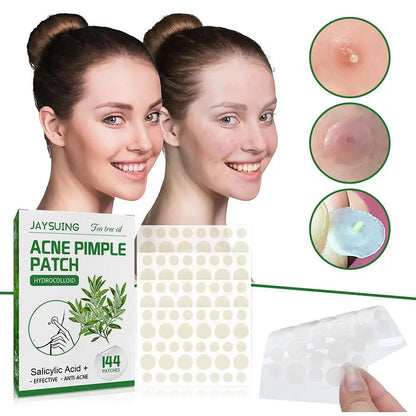 Invisible Hydrocolloid Acne Patch With Tea Tree Oil. 144 pcs.
