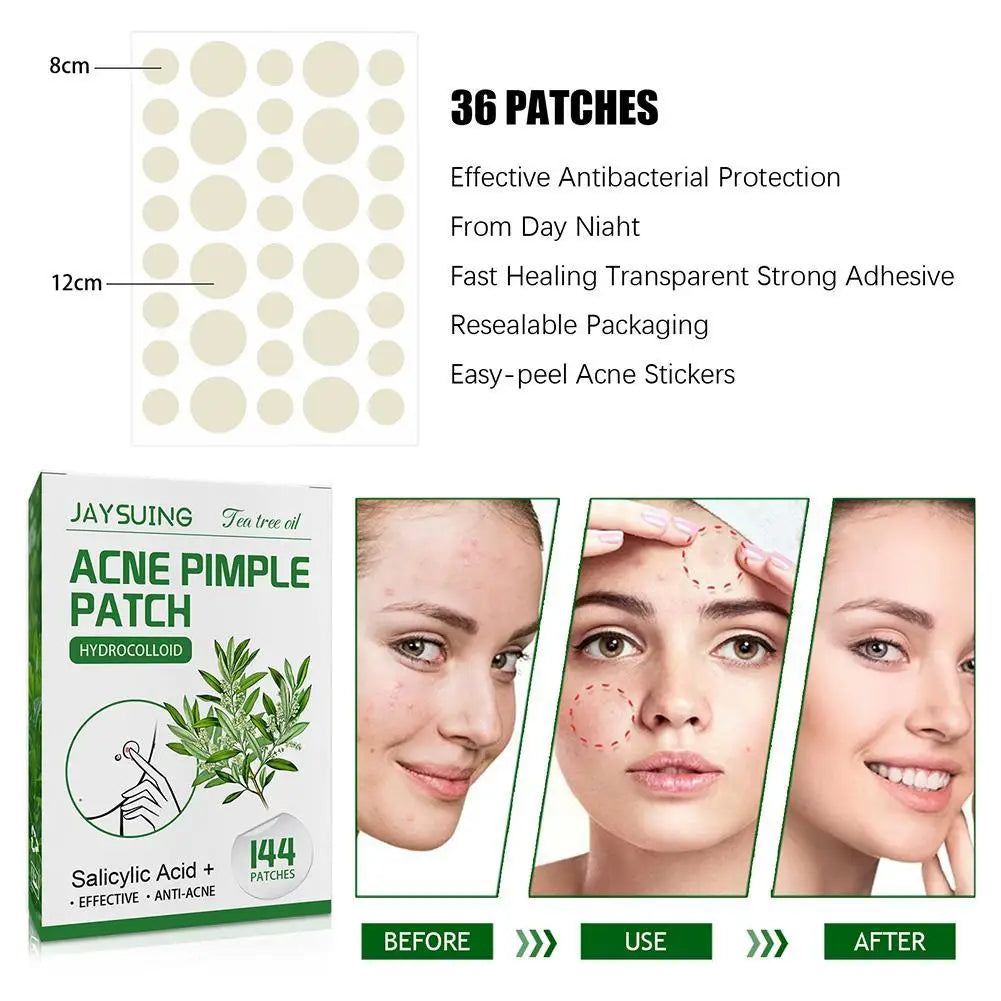 Invisible Hydrocolloid Acne Patch With Tea Tree Oil. 144 pcs.