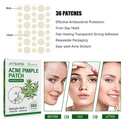 Invisible Hydrocolloid Acne Patch With Tea Tree Oil. 144 pcs.