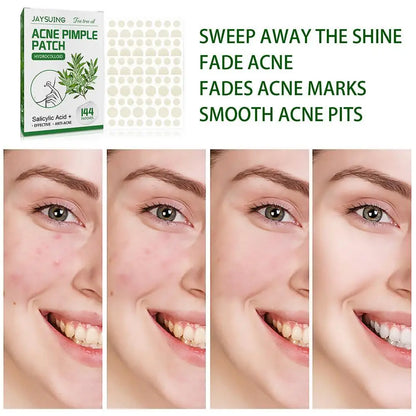 Invisible Hydrocolloid Acne Patch With Tea Tree Oil. 144 pcs.