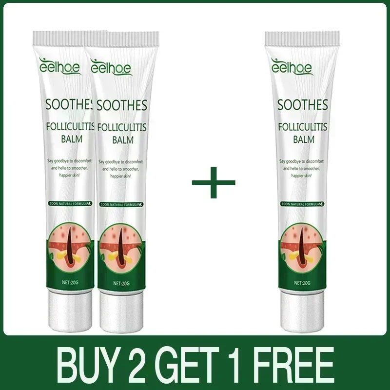 Zynrae anti-Acne Cream – Removes Pimples, Cysts & Blackheads