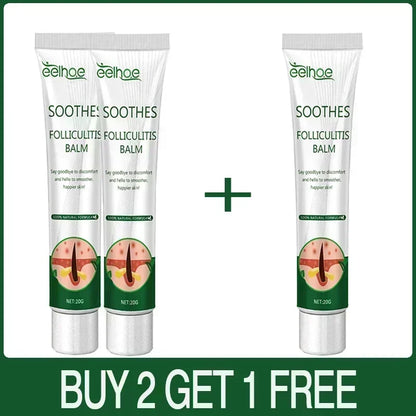 Zynerae Anti-Acne Cream – Removes Pimples, Cysts and Blackheads.