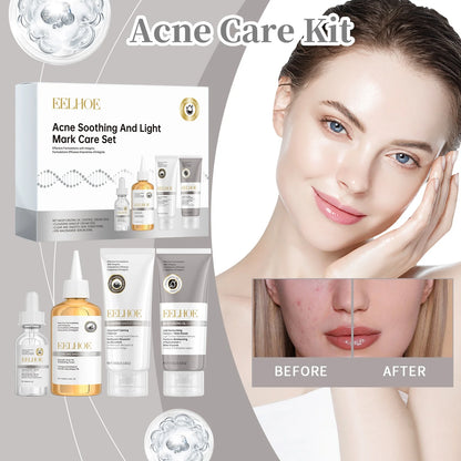 Acne Care Kit Brightening Skin Tone Fade Acne Scars Improving Skin Texture Deeply Moisturizing the Skin Facial Skincare Products