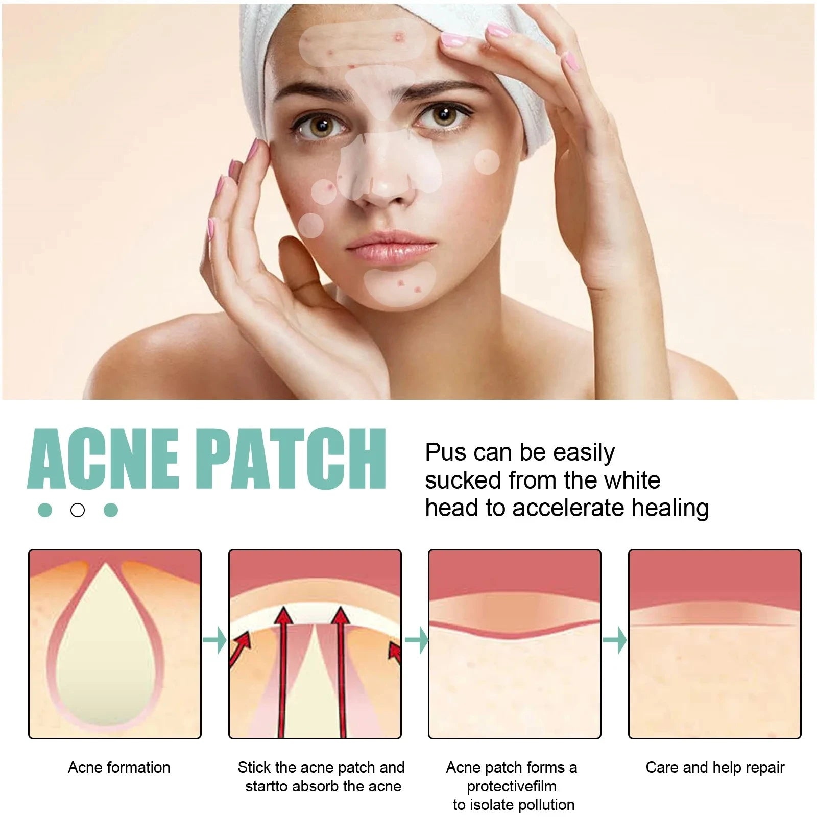 132 Pcs Hydrocolloid Acne Pimple Patches — Invisible Spot Stickers for Face