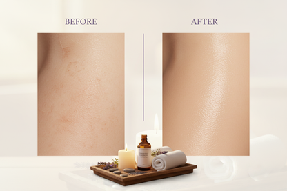 Before and after skin comparison showing results of Expressions Lavender Massage Oil